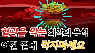 혈관을 딱딱하게 만드는 '이 음식' 이건 그냥 버리세요 (치매, 뇌졸증, 심장병, 만성염증의 원인이 되는 최악의 음식)