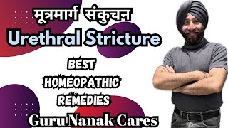 URETHRAL STRICTURE | How Homeopathy Helps...? मूत्रमार्ग संकुचन की बेस्ट होम्योपैथिक दवाऐं