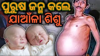 ପୁରୁଷ ହେଲେ ଗର୍ଭବତୀ 😜ଜନ୍ମକଲେ ଯାଆଁଳା ଶିଶୁ,,😁 news video,