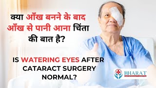 क्या आँख बनने के बाद आँख से पानी आना चिंता की बात है? | Is Watering Eyes After Surgery Normal?