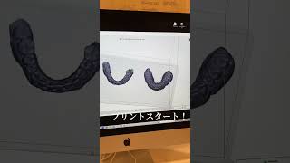 【最新】３Dプリンターで歯の模型を作る🦷#shorts #インビザライン矯正 #歯列矯正 #歯科矯正 #歯科衛生士＃模型#3d #3dプリンター #インビザライン