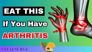 Top 10 Fruits If You Have Arthritis Eat Now!