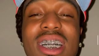 Quavo Teeth 🦷  Without Grill 😳