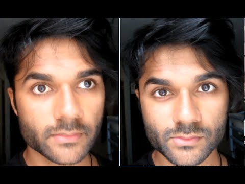 How To Fix Your Lazy Eye How To Fix Your Lazy Eye