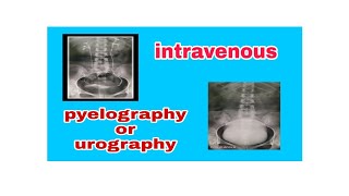 Intravenous Pyelography / Urography (IVP / IVU)