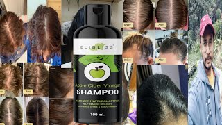 Elibliss Apple Cider Vinegar Shampoo | Honest Review