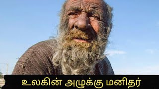 60 வருடமாக குளிக்கவே இல்லை 😳 World's Dirtiest Man Dies at 94