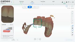 8 CAMEO elegant Ⅲ  Oral scanning orthodontic guidance video