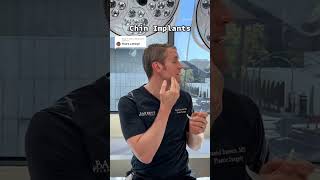 Let’s Talk About Chin Implants! 🤔