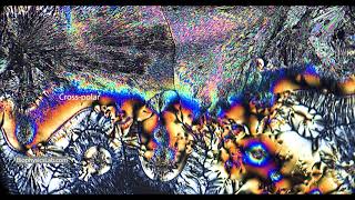 Vitamin C Using Polarizing Light Microscope: Brightfield to Cross-Polar