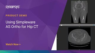 Using Simpleware AS Ortho for Hip CT | Synopsys