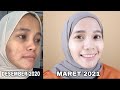 SKINCARE ROUTINES UNTUK MENGHILANGKAN JERAWAT DAN BRUNTUSAN MEMBANDEL SERTA BISA MENCERAHKAN WAJAH