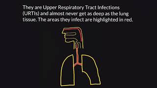 Pneumonia Part 2