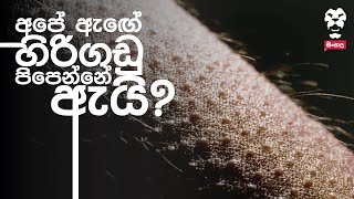 අපේ ඇඟේ හිරිගඩු පිපෙන්නේ ඇයි?