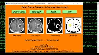 Python Code for Brain Tumor Detection Using CNN Final Year Project Biomedical Project