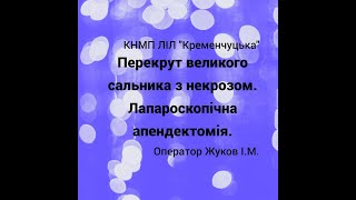 Лапароскопічна резекція великого сальника. Лапароскопічна апендектомія.