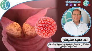 #فيروسHPV_وارتباطه_بسرطان_عنق_الرحم مع الأستاذ الدكتور #حميد_سليمان على منصة #حكيمك_دليلك ♥️