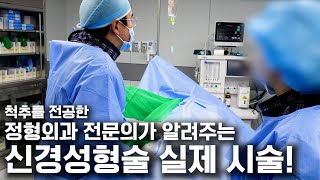 신경성형술 시술 실시간 보기 / 통증 없는 척추·허리 치료법