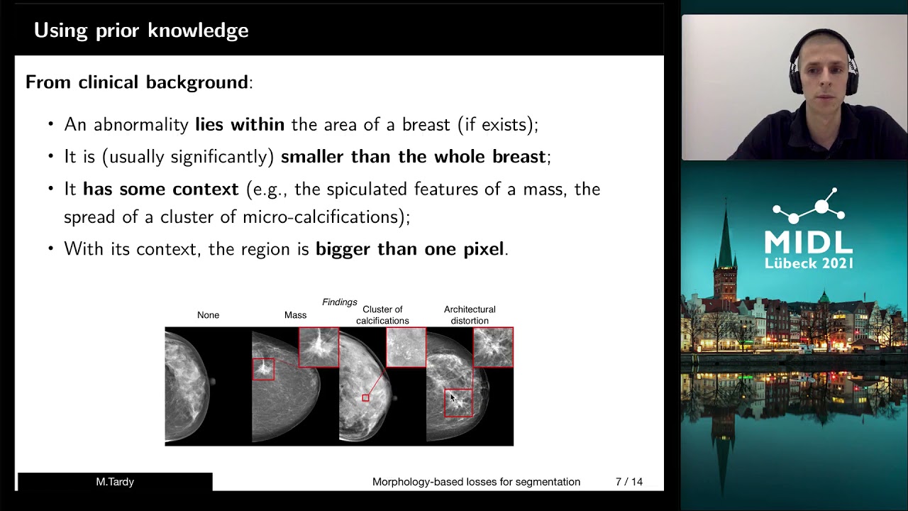 MIDL 2021, H8, Tardy Et. Al., Short Oral - YouTube