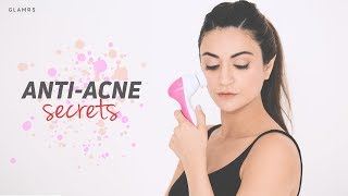 How To: Combat Pimples And Acne | Affordable And Effective Remedies