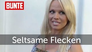Pamela Anderson - Seltsame Flecken am Körper   - BUNTE TV