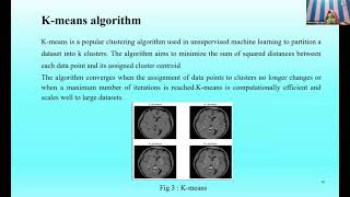 Image Segmentation and Classification using Neural Network