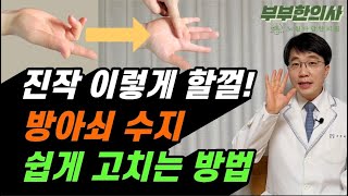 478. 방아쇠수지 통증 완화 꿀팁! 진작 이렇게 할껄 | 한의학박사, 침구과전문의, 산청김, 김경태원장 ㅣft 부부한의사