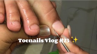 Toenails Vlog #23