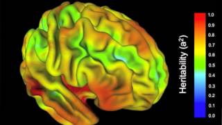 Why delayed onset of mental illness? Genes impact suspect brain areas late