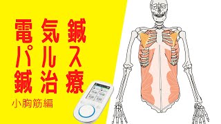 小胸筋の電気鍼-肩関節障害、胸郭出口症候群