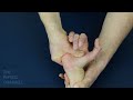 midcarpal pivot shift test