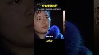 湖北女子生下奇特雙胞胎，竟分不清孩子的性別，醫生看了連連搖頭 #老A檔案室 #大案紀實錄 #案件調查 #懸案密碼 #懸案破解