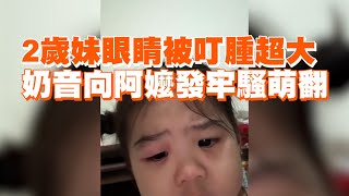 2歲妹眼睛被叮腫超大　奶音向阿嬤發牢騷萌翻