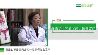 感染了人乳头瘤病毒（HPV）的孕妇必须剖宫产吗？