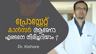 പ്രോസ്റ്റേറ്റ് കാൻസർ എങ്ങനെ തിരിച്ചറിയാം ? | Prostate Cancer Malayalam | Arogyam