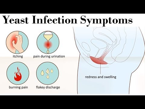 Yeast Infection Symptoms | How You Can Diagnose The Severe Yeast Infection Symptom Yeast Infection Symptoms | How You Can Diagnose The Severe Yeast Infection Symptom