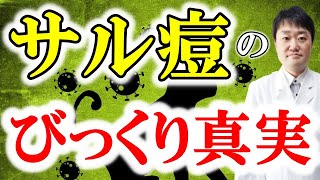 【サル痘】はこんな症状　テレビが報じないサル痘の真実や予防法などの最新情報を、論文などから医者がすべてお伝えします　子供の例や死亡例も