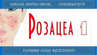 РОЗАЦЕА 1 | Rosacea | Лечится ли, причины и ошибки