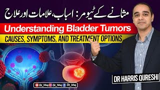 "Understanding Bladder Tumors: Causes, Symptoms, and Treatment Options -مثانے کے ٹیومر -Urdu Hindi