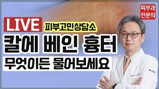 [LIVE 피부고민상담소] 자해흉터, 칼에베인흉터 레이저 제거 치료 | 자상흉터 다 물어보세요!