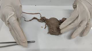 Demo uterus