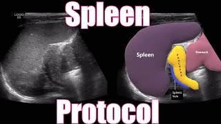 Spleen Protocol