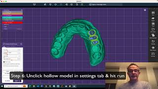 Exocad: easy 3d printing models with extra dies and support pins