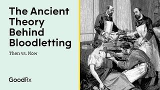 Bloodletting (Phlebotomy) Through the Ages | Then vs. Now | GoodRx