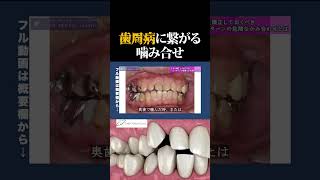 歯磨きだけでは解決しない歯周病の原因とは？（Part2）【歯科医師が語る】