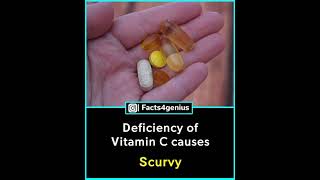 Vitamin A B C D Deficiency effects #Shorts