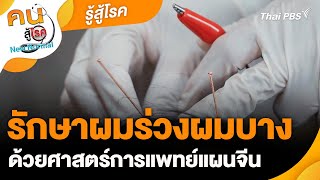 รักษาผมร่วงผมบางด้วยศาสตร์การแพทย์แผนจีน | รู้สู้โรค | คนสู้โรค