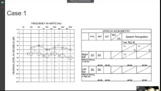 speech audiometry practice