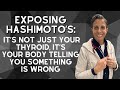 Exposing Hashimoto’s: It’s Not Just Your Thyroid, It’s Your Body Telling You Something is WRONG