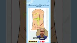 Abdominal Incisions: Quick recap | Dr. Amrit Nasta